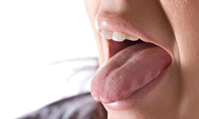 
Những người bị tình trạng này còn dễ mắc thêm hội chứng miệng bỏng rát, trong đó triệu chứng điển hình là cảm giác nóng rát gây đau trong miệng. Ảnh: minh họa
