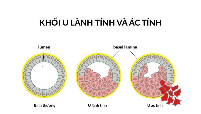 


Ứng dụng của Classification trong y học&nbsp;
