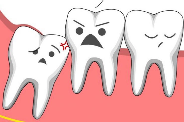Tiểu phẫu cũng thường được sử dụng trong việc điều trị các bệnh lý liên quan tới răng hàm mặt