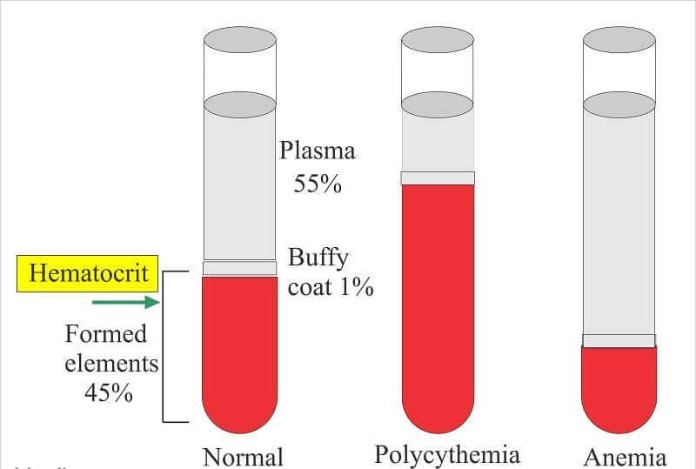 
Những thông tin cơ bản về Hematocrit là gì
