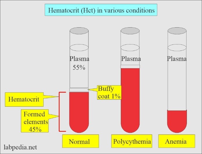 
Lí do chúng ta nên biết chỉ số Hct cao hoặc thấp là gì?
